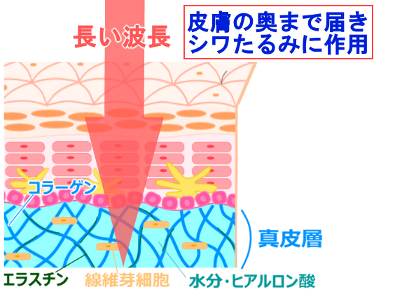 img_20170704-224051.png