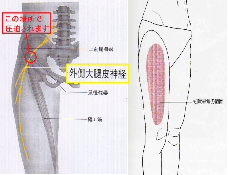 【公式】 はいからや鍼灸整骨院 ブログ